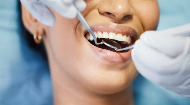 Best Emergency Wisdom Teeth Removal in Mascotte, FL